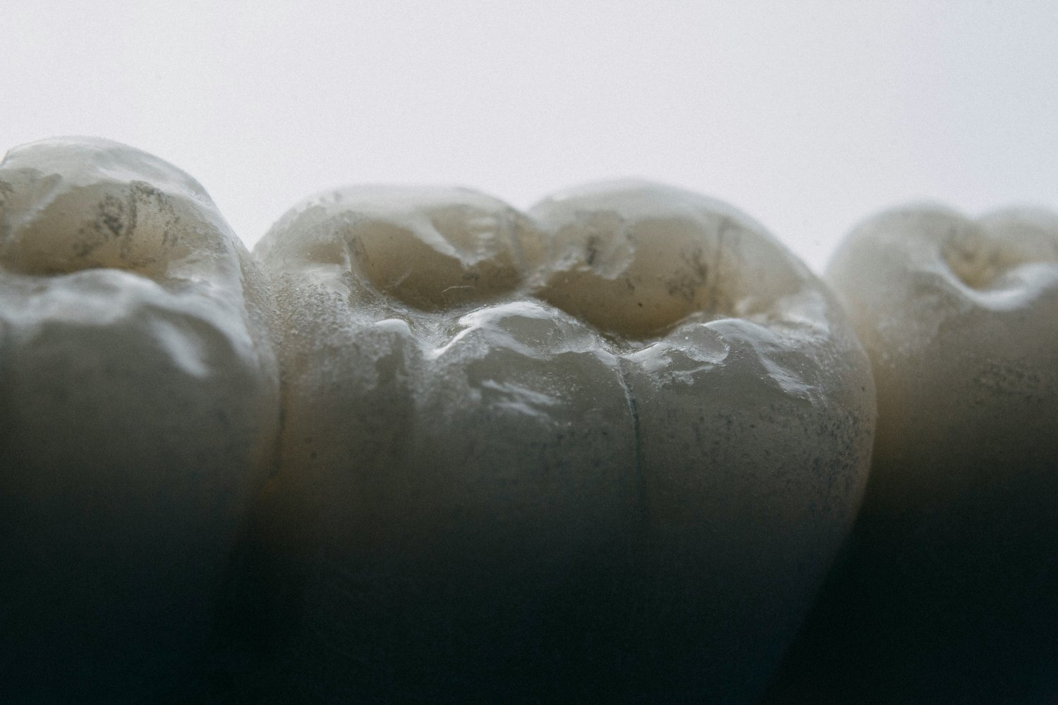 How Tooth Loss Can Damage Memory — Every Movie Has a Lesson